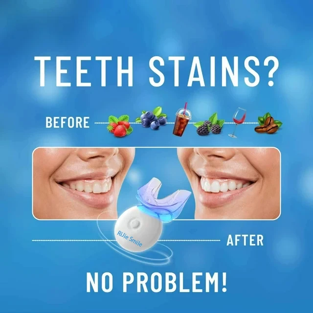 Perangkat Pemutih Gigi Nirkabe - Teeth Whitening At Home Kit ulasan dan harga