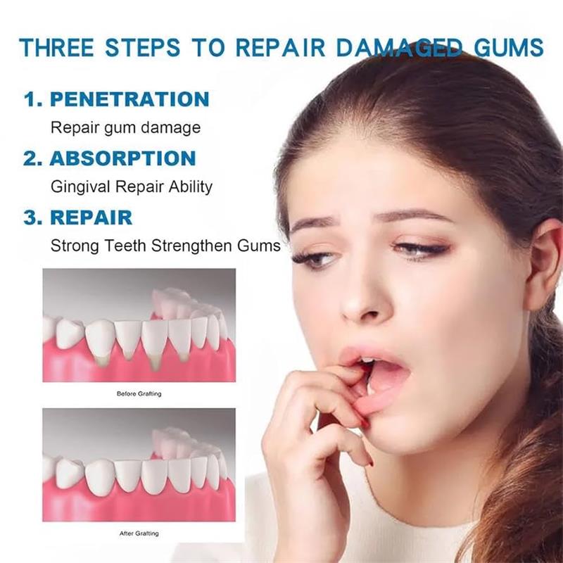 Serum Perawatan Perbaikan Gusi - Teeth Whitening Gingival Barrier ulasan dan harga