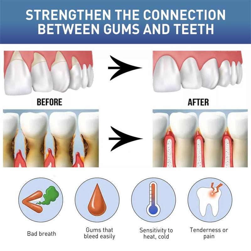 Serum Perawatan Perbaikan Gusi - Teeth Whitening Gingival Barrier ulasan dan harga