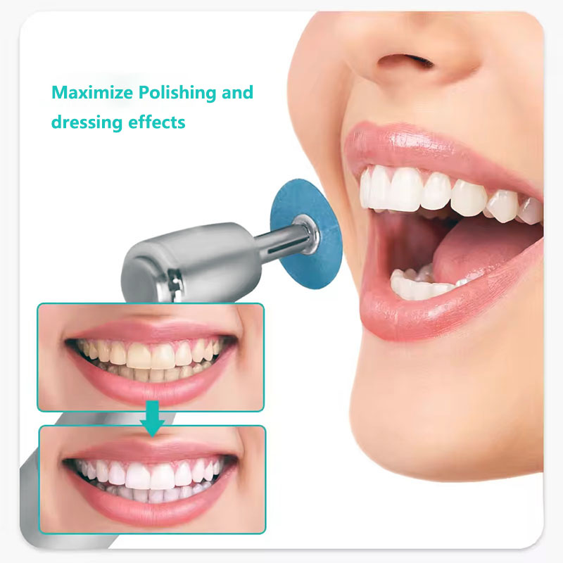 40 Buah Cakram Pemoles Gigi Ba - Teeth Whitening Express ulasan dan harga