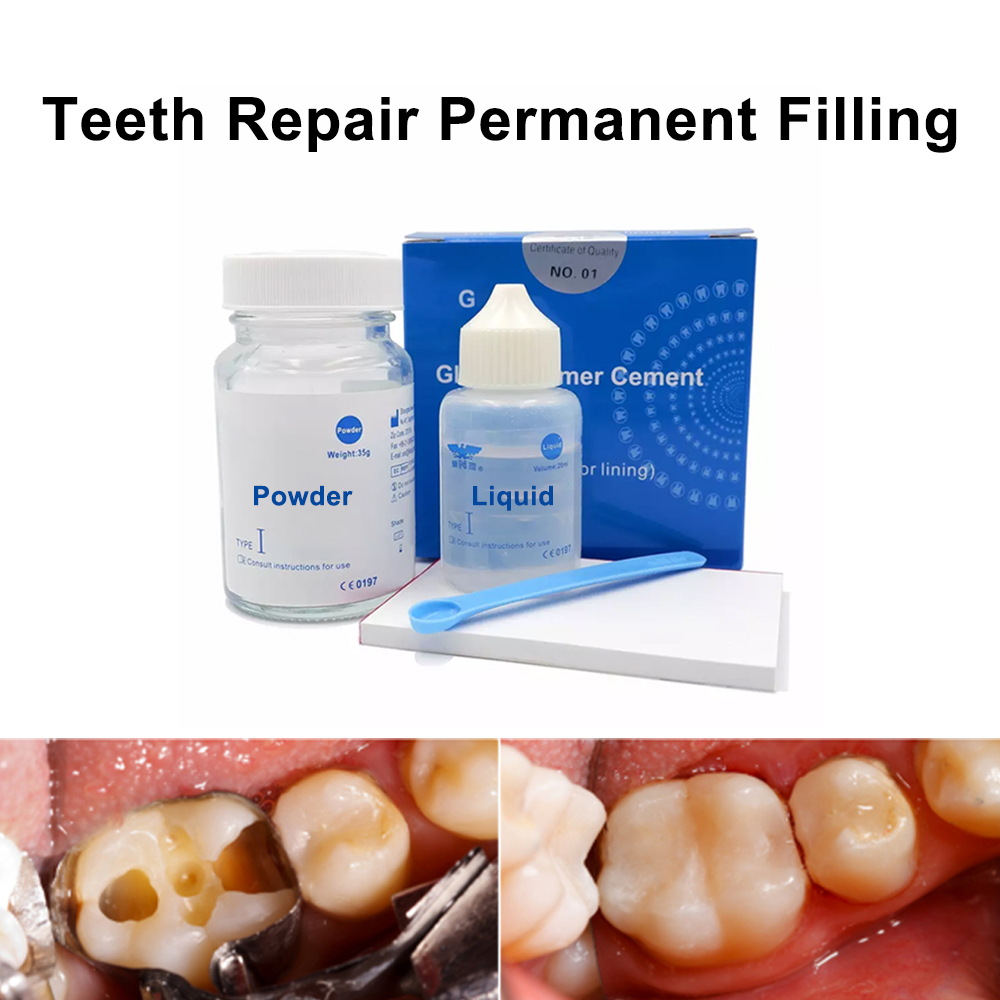 Kit Perbaikan Tambal Gigi Perm - Teeth Whitening At Home Kit ulasan dan harga